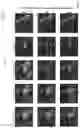 Fig. 10 - System and method for fully automatic LV segmentation of myocardial first-pass perfusion images