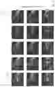 Fig. 11 - System and method for fully automatic LV segmentation of myocardial first-pass perfusion images