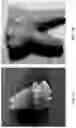 Fig. 02 - Method and System for Detecting Molar Incisor Hypomineralization Using High Resolution Raman Analyses of Tooth Composition