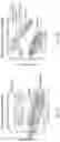 Fig. 14 - Method and System for Detecting Molar Incisor Hypomineralization Using High Resolution Raman Analyses of Tooth Composition