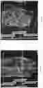 Fig. 04 - SYSTEM AND METHOD FOR IMAGING AND SEGMENTATION OF CAVERNOUS NERVES