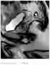 Fig. 05 - SYSTEM AND METHOD FOR IMAGING AND SEGMENTATION OF CAVERNOUS NERVES