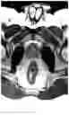 Fig. 06 - SYSTEM AND METHOD FOR IMAGING AND SEGMENTATION OF CAVERNOUS NERVES