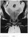 Fig. 07 - SYSTEM AND METHOD FOR IMAGING AND SEGMENTATION OF CAVERNOUS NERVES