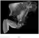Fig. 09 - SYSTEM AND METHOD FOR IMAGING AND SEGMENTATION OF CAVERNOUS NERVES