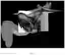 Fig. 10 - SYSTEM AND METHOD FOR IMAGING AND SEGMENTATION OF CAVERNOUS NERVES
