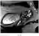 Fig. 11 - SYSTEM AND METHOD FOR IMAGING AND SEGMENTATION OF CAVERNOUS NERVES
