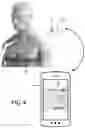 Fig. 06 - Tri-axial seismocardiography devices and methods