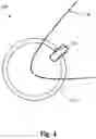 Fig. 02 - MINIATURE WEARABLE CAPNOGRAPHY DEVICE