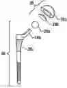 Fig. 01 - Systems and methods for intra-operative pelvic registration