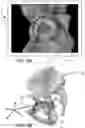 Fig. 12 - Systems and methods for intra-operative pelvic registration