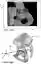Fig. 14 - Systems and methods for intra-operative pelvic registration