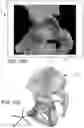 Fig. 15 - Systems and methods for intra-operative pelvic registration