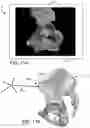 Fig. 18 - Systems and methods for intra-operative pelvic registration