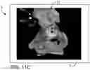 Fig. 19 - Systems and methods for intra-operative pelvic registration