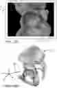 Fig. 20 - Systems and methods for intra-operative pelvic registration