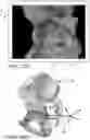Fig. 21 - Systems and methods for intra-operative pelvic registration
