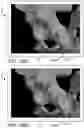 Fig. 23 - Systems and methods for intra-operative pelvic registration