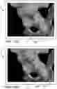 Fig. 24 - Systems and methods for intra-operative pelvic registration