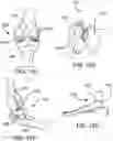 Fig. 26 - Systems and methods for intra-operative pelvic registration