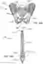 Fig. 27 - Systems and methods for intra-operative pelvic registration