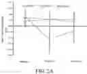 Fig. 04 - ASYMMETRICAL RHYTHMIC AUDITORY CUEING BASED GAIT MODIFICATION