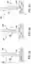 Fig. 12 - SENSOR INSERTER HAVING INTRODUCER