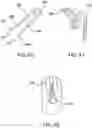 Fig. 17 - SENSOR INSERTER HAVING INTRODUCER