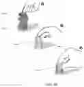Fig. 43 - MEDICAL DEVICE INSERTERS AND PROCESSES OF INSERTING AND USING MEDICAL DEVICES