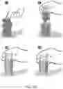 Fig. 44 - MEDICAL DEVICE INSERTERS AND PROCESSES OF INSERTING AND USING MEDICAL DEVICES