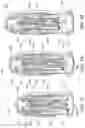 Fig. 55 - MEDICAL DEVICE INSERTERS AND PROCESSES OF INSERTING AND USING MEDICAL DEVICES