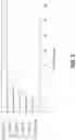 Fig. 07 - Detection and localization of myocardial infarction using vectorcardiography
