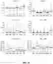Fig. 12 - Detection and localization of myocardial infarction using vectorcardiography