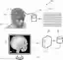 Fig. 01 - SYSTEM AND METHOD FOR MODELING NEUROLOGICAL ACTIVITY