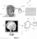 Fig. 02 - SYSTEM AND METHOD FOR MODELING NEUROLOGICAL ACTIVITY