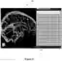 Fig. 07 - SYSTEM AND METHOD FOR MODELING NEUROLOGICAL ACTIVITY