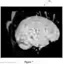 Fig. 08 - SYSTEM AND METHOD FOR MODELING NEUROLOGICAL ACTIVITY