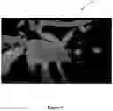 Fig. 10 - SYSTEM AND METHOD FOR MODELING NEUROLOGICAL ACTIVITY