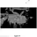 Fig. 11 - SYSTEM AND METHOD FOR MODELING NEUROLOGICAL ACTIVITY