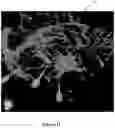 Fig. 12 - SYSTEM AND METHOD FOR MODELING NEUROLOGICAL ACTIVITY