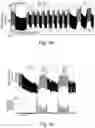Fig. 06 - SYSTEM AND METHOD FOR CLOSED LOOP CONTROL OF AUTONOMIC FUNCTION