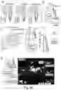 Fig. 11 - SYSTEM AND METHOD FOR CLOSED LOOP CONTROL OF AUTONOMIC FUNCTION