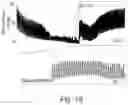 Fig. 18 - SYSTEM AND METHOD FOR CLOSED LOOP CONTROL OF AUTONOMIC FUNCTION