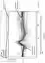 Fig. 35 - METHODS AND APPARATUS FOR REMOVING ARTIFACTS FROM AN ELECTRORETINOGRAM
