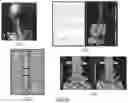 Fig. 12 - SYSTEMS AND METHODS FOR IMPROVING CHRONIC CONDITION OUTCOMES USING PERSONALIZED AND HISTORICAL DATA
