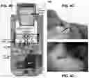 Fig. 14 - Wireless and noninvasive epidermal electronics
