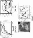 Fig. 40 - Wireless and noninvasive epidermal electronics