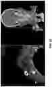 Fig. 41 - Wireless and noninvasive epidermal electronics