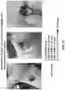 Fig. 45 - Wireless and noninvasive epidermal electronics