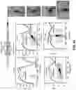 Fig. 61 - Wireless and noninvasive epidermal electronics